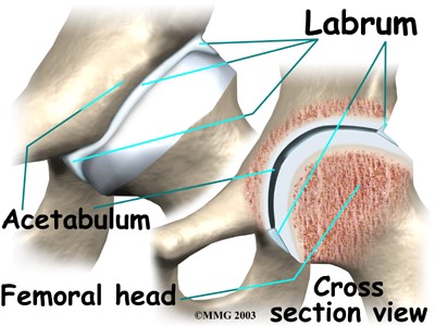 Labral-Injury-Hip-Joint-1